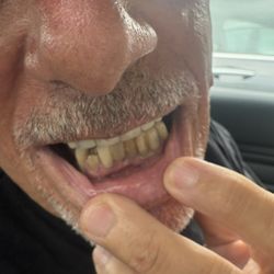 Signature Smiles - Before