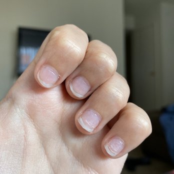 Ocean Spa And Nails - After I took them off. - Waxing Near Me - Reno, Nevada Ocean Spa And Nails - After I took them off. - Waxing Near Me - Reno, Nevada