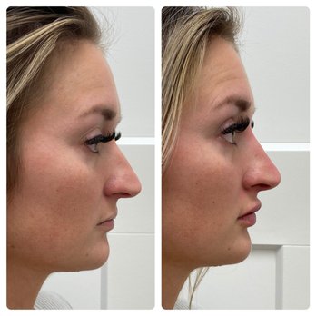 RO Aesthetics - Medical Spas Near Me - Salt Lake City, Utah RO Aesthetics - Medical Spas Near Me - Salt Lake City, Utah
