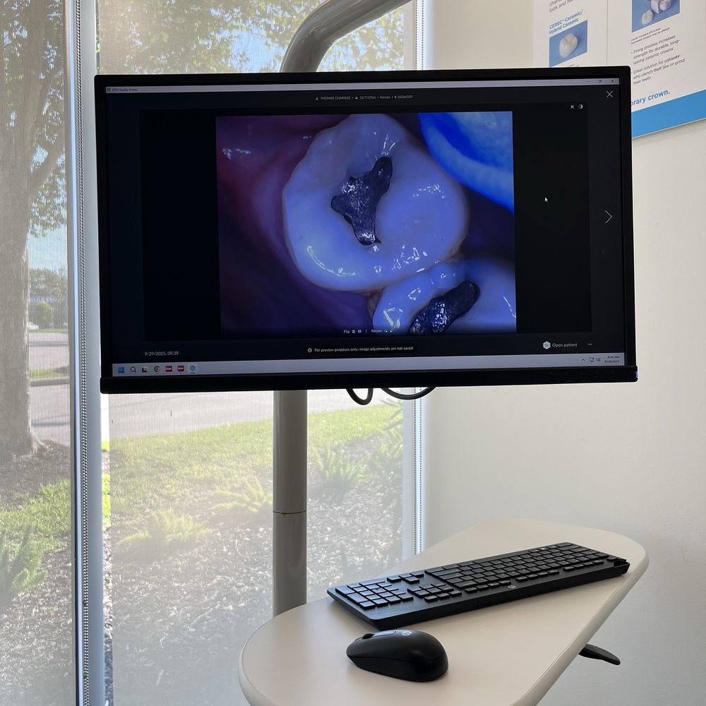Pasadena Modern Dentistry - Had to get fillings replaced - General Dentistry Near Me - Pasadena, Texas Pasadena Modern Dentistry - Had to get fillings replaced - General Dentistry Near Me - Pasadena, Texas