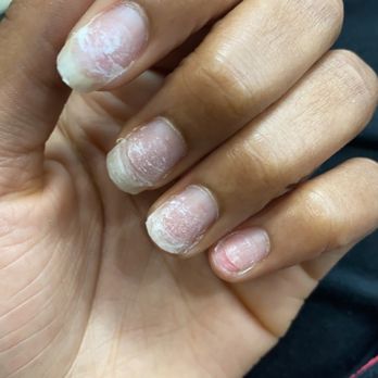 TD Nails - pinky that she ripped off.  said they don't do soak offs, lazy much? - Nail Salons Near Me - Atlanta, Georgia
