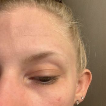 First Class Cosmetics - What my eyebrows look like naturally. - Tattoo Removal Near Me - New York, New York