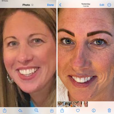 Goodbye 80's Brow! - This client wanted to update her brows that were aging her ....don't walk around with 80's brows and up to date hair and wardrobe...it will ruin your vibe! Goodbye 80's Brow! - This client wanted to update her brows that were aging her ....don't walk around with 80's brows and up to date hair and wardrobe...it will ruin your vibe!