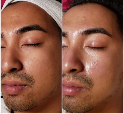 CRYSTAL PURE SKIN CARE - 465 Photos - 592 Ridge Rd, North Arlington