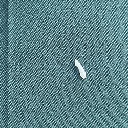 Dental Options - On 1st day I received the retainer tooth chip