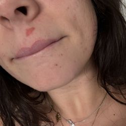 Beautique Nails & Spa - Wax burn