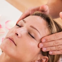 The Holistic Clinic - Acupuncture Facial Rejuvenation Acupuncture Nashville