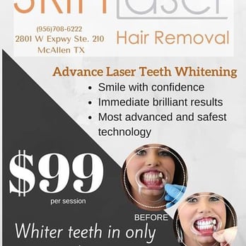 Skin Laser - Teeth Whitening! - Skin Care Near Me - McAllen, Texas Skin Laser - Teeth Whitening! - Skin Care Near Me - McAllen, Texas