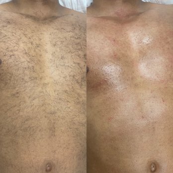 Knova Dream Spa - #chestwax - Waxing Near Me - Livermore, California