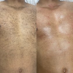#chestwax