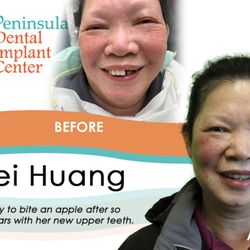 Peninsula Dental Implant Center - Smile with new, fixed teeth