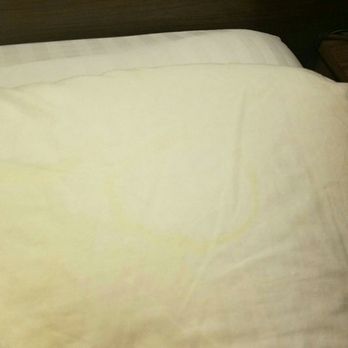 Country Manor Motel - I thought I saw a stain peeking through the pillow case and when I went to check this is what I found. - Hotels Near Me - Watkins, Colorado