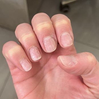 Enail - They completely ruined my healthy nails - Nail Salons Near Me - New York, New York