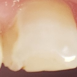 Richard Stacey, DDS - Stacey Family Dental