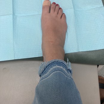 Gabriel J Halperin D.P.M. - Before - Podiatrists Near Me - Los Angeles, California Gabriel J Halperin D.P.M. - Before - Podiatrists Near Me - Los Angeles, California