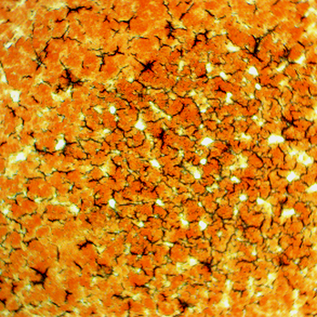 The Wellness Trinity - Dry Blood Cell Analysis: Liver and adrenal stress - Naturopathic/Holistic Near Me - Henderson, Nevada The Wellness Trinity - Dry Blood Cell Analysis: Liver and adrenal stress - Naturopathic/Holistic Near Me - Henderson, Nevada