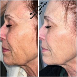 Meraki Skin Spa - Skin care
