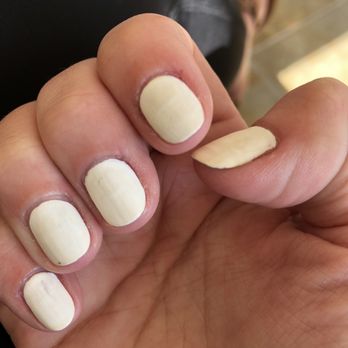 Fashion Nails - Streaking. Not fully coated. Discoloration. Less than 24 hours after I got them done!!! - Nail Salons Near Me - Arden, North Carolina Fashion Nails - Streaking. Not fully coated. Discoloration. Less than 24 hours after I got them done!!! - Nail Salons Near Me - Arden, North Carolina