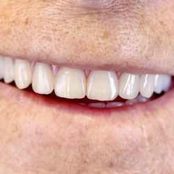 Aesthetic Denture Clinic