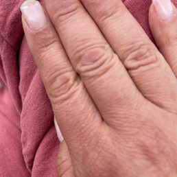 Chipped nails Chipped nails