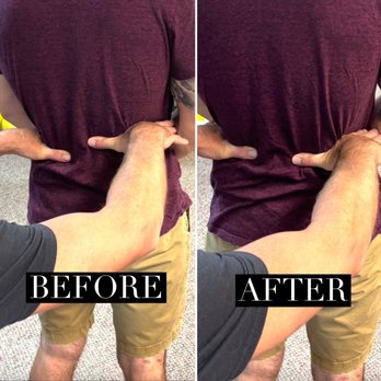 Revive Orthopedic and Spinal Therapy - Before and after Pelvis alignment after 1 treatment! - Physical Therapy Near Me - Painesville, Ohio Revive Orthopedic and Spinal Therapy - Before and after Pelvis alignment after 1 treatment! - Physical Therapy Near Me - Painesville, Ohio