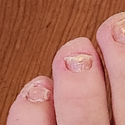 Sisters Nails and Spa - This is after the pedi. No time spent rounding out nails, cut too short, and painful.