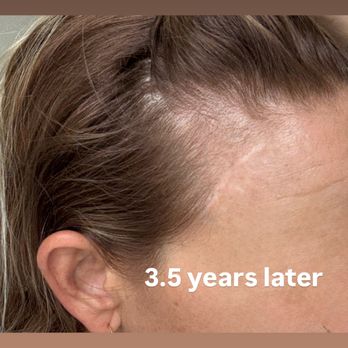 Christopher C. Lo, MD - Los Angeles - Years later, the horror I see in the mirror every day. - Ophthalmologists Near Me - Los Angeles, California Christopher C. Lo, MD - Los Angeles - Years later, the horror I see in the mirror every day. - Ophthalmologists Near Me - Los Angeles, California