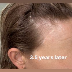 Christopher C. Lo, MD - Los Angeles - Years later, the horror I see in the mirror every day.