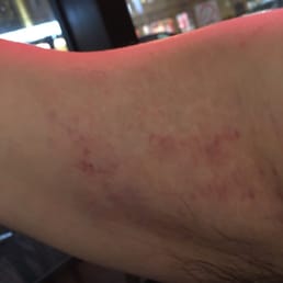 This was as a result of my standing up for myself because I was being harassed by two lesbians. This was as a result of my standing up for myself because I was being harassed by two lesbians.