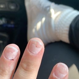 You can see the blood on my cuticle when she cut it too short and cut my skin