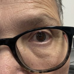 Li & Liao Optometry - Southwest Bakersfield - Keep your eyes open!