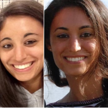 Beauty & Brow - Before vs. after - Hair Removal Near Me - Houston, Texas Beauty & Brow - Before vs. after - Hair Removal Near Me - Houston, Texas