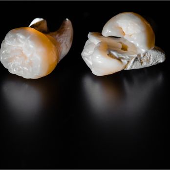 Isaac Kim - DDS - General Dentistry Near Me - San Jose, California Isaac Kim - DDS - General Dentistry Near Me - San Jose, California