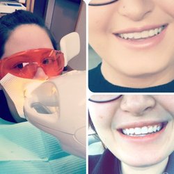After using their in office Phillips's Zoom! Teeth whitening