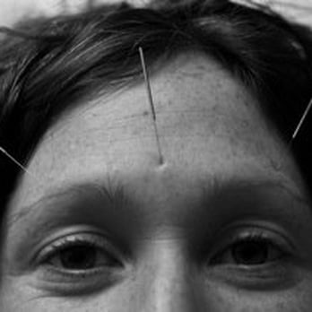 Confluence Clinic - Acupuncture Near Me - Portland, Oregon Confluence Clinic - Acupuncture Near Me - Portland, Oregon