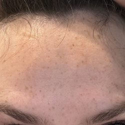 The Whole Tooth - Lifting eyebrows.