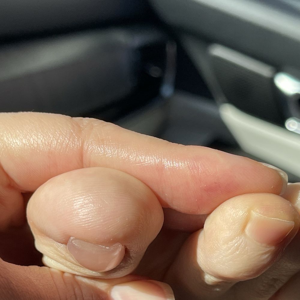 Daisy Nails Spa - Thick acrylic that's tapered on a weird rectangular shape instead of squared like my left foot natural nail - Nail Salons Near Me - Yuba City, California Daisy Nails Spa - Thick acrylic that's tapered on a weird rectangular shape instead of squared like my left foot natural nail - Nail Salons Near Me - Yuba City, California