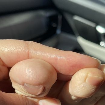 Daisy Nails Spa - Thick acrylic that's tapered on a weird rectangular shape instead of squared like my left foot natural nail - Nail Salons Near Me - Yuba City, California