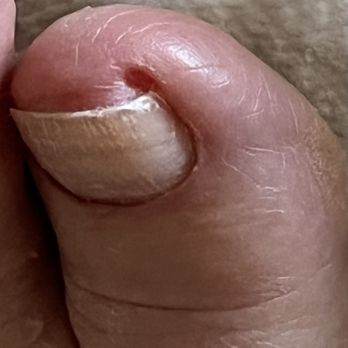 Omni Nails - Left big toe, which was cut by pedicure gal. - Nail Salons Near Me - San Diego, California Omni Nails - Left big toe, which was cut by pedicure gal. - Nail Salons Near Me - San Diego, California