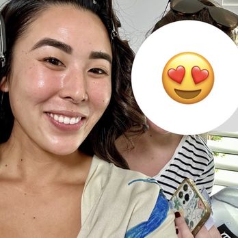Sanctuary Spa - Results of one year of consistent diamond glow facials and a co2 lift mask (ok and Botox). - Skin Care Near Me - Long Beach, California