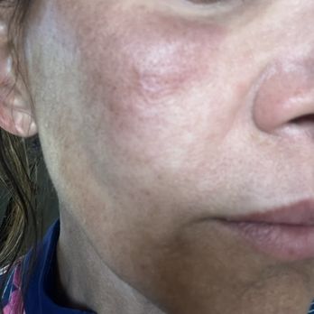 Alani Skin MD - Damage to my skin - Skin Care Near Me - Mesa, Arizona Alani Skin MD - Damage to my skin - Skin Care Near Me - Mesa, Arizona