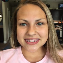 Lenk Orthodontics - BEFORE