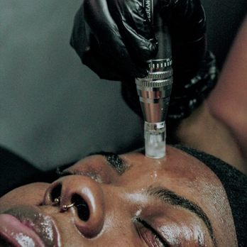 Complexxions Skin Lab - Microneedling / Nanoneedling treatments can offer great results for large pores, acne scarring, hyperpigmentation, anti-aging, etc - Waxing Near Me - Houston, Texas Complexxions Skin Lab - Microneedling / Nanoneedling treatments can offer great results for large pores, acne scarring, hyperpigmentation, anti-aging, etc - Waxing Near Me - Houston, Texas