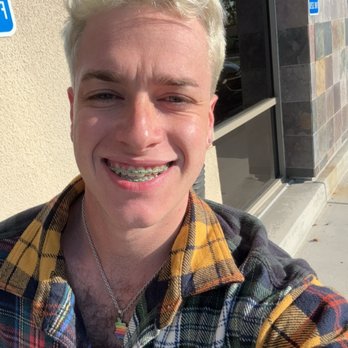 Elite Orthodontics - Prior to braces being removed Smile Teeth - Orthodontists Near Me - San Diego, California Elite Orthodontics - Prior to braces being removed Smile Teeth - Orthodontists Near Me - San Diego, California