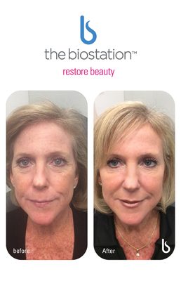 the biostation by null