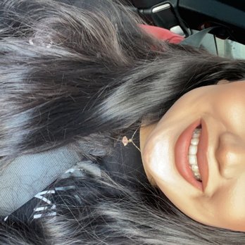 Ethos Advanced Dental Care - Invisalign isn't too noticeable unless your up close - General Dentistry Near Me - Temecula, California Ethos Advanced Dental Care - Invisalign isn't too noticeable unless your up close - General Dentistry Near Me - Temecula, California