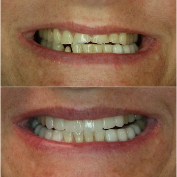 Leslie P Dillard, DDS - Beautiful transformations.... they happen here every day. - General Dentistry Near Me - Nashville, Tennessee Leslie P Dillard, DDS - Beautiful transformations.... they happen here every day. - General Dentistry Near Me - Nashville, Tennessee
