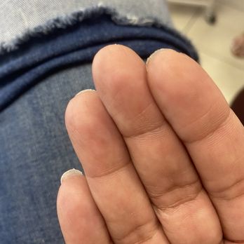 Aborn Nail - You can see the different lengths and rough edges - Nail Salons Near Me - San Jose, California Aborn Nail - You can see the different lengths and rough edges - Nail Salons Near Me - San Jose, California