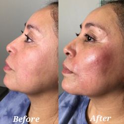 The Botox Bar and Aesthetics