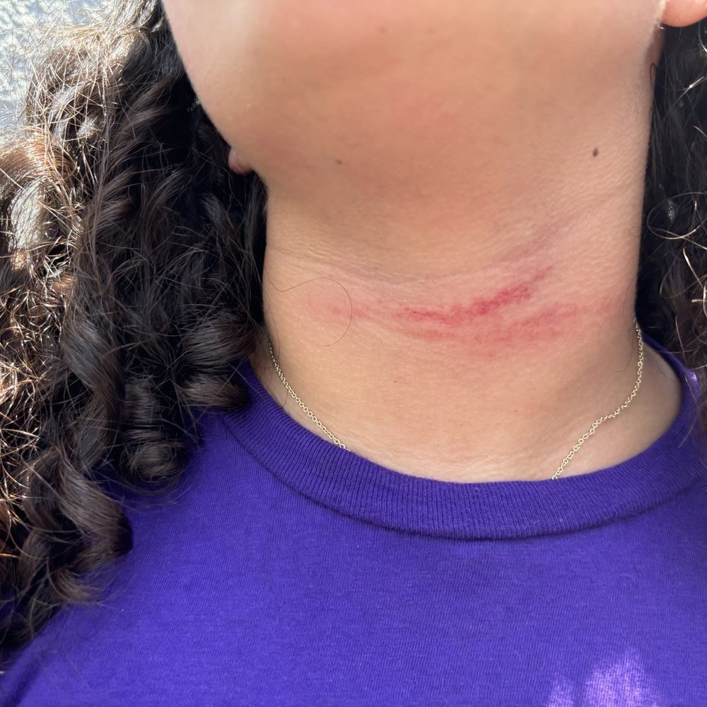 Go Kart World - Choking of the seatbelt because wasn't adjusted properly - Amusement Parks Near Me - Carson, California Go Kart World - Choking of the seatbelt because wasn't adjusted properly - Amusement Parks Near Me - Carson, California